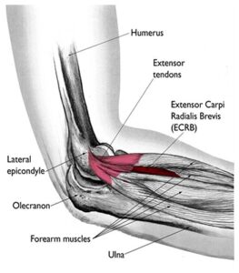 HOME EXERCISE PROGRAM – Lateral Epicondylitis – Orthoguyz